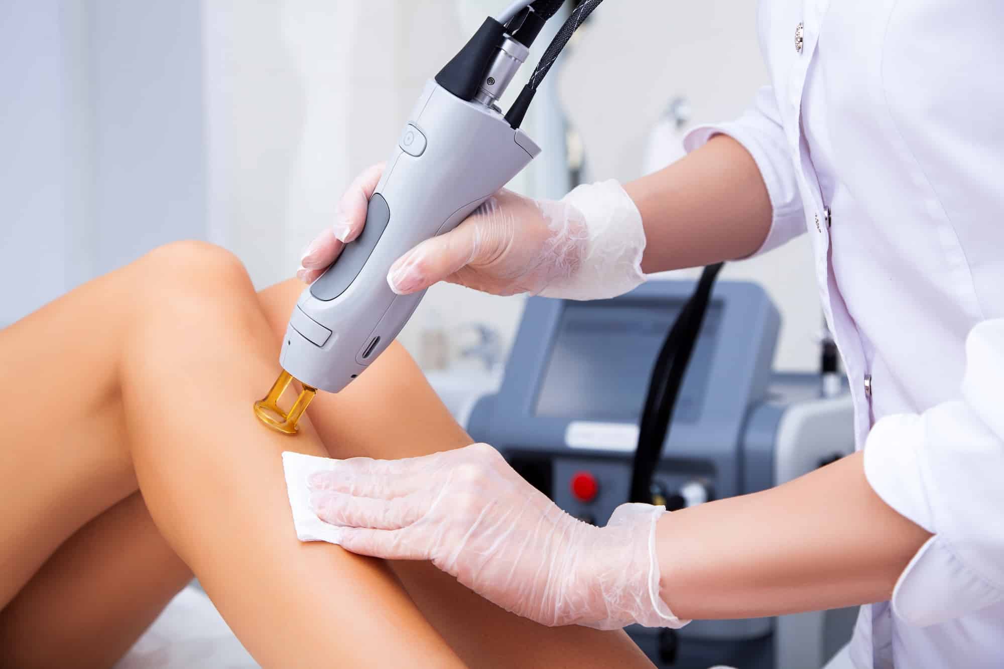 laser treatment for hair removal Tequesta FL