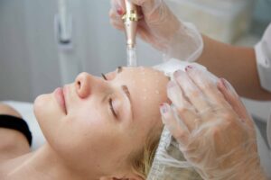 microneedling treatment North Palm Beach FL